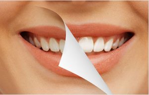 Cosmetic Dentist Denver, CO