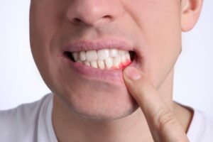 Abscess Treatment denver co